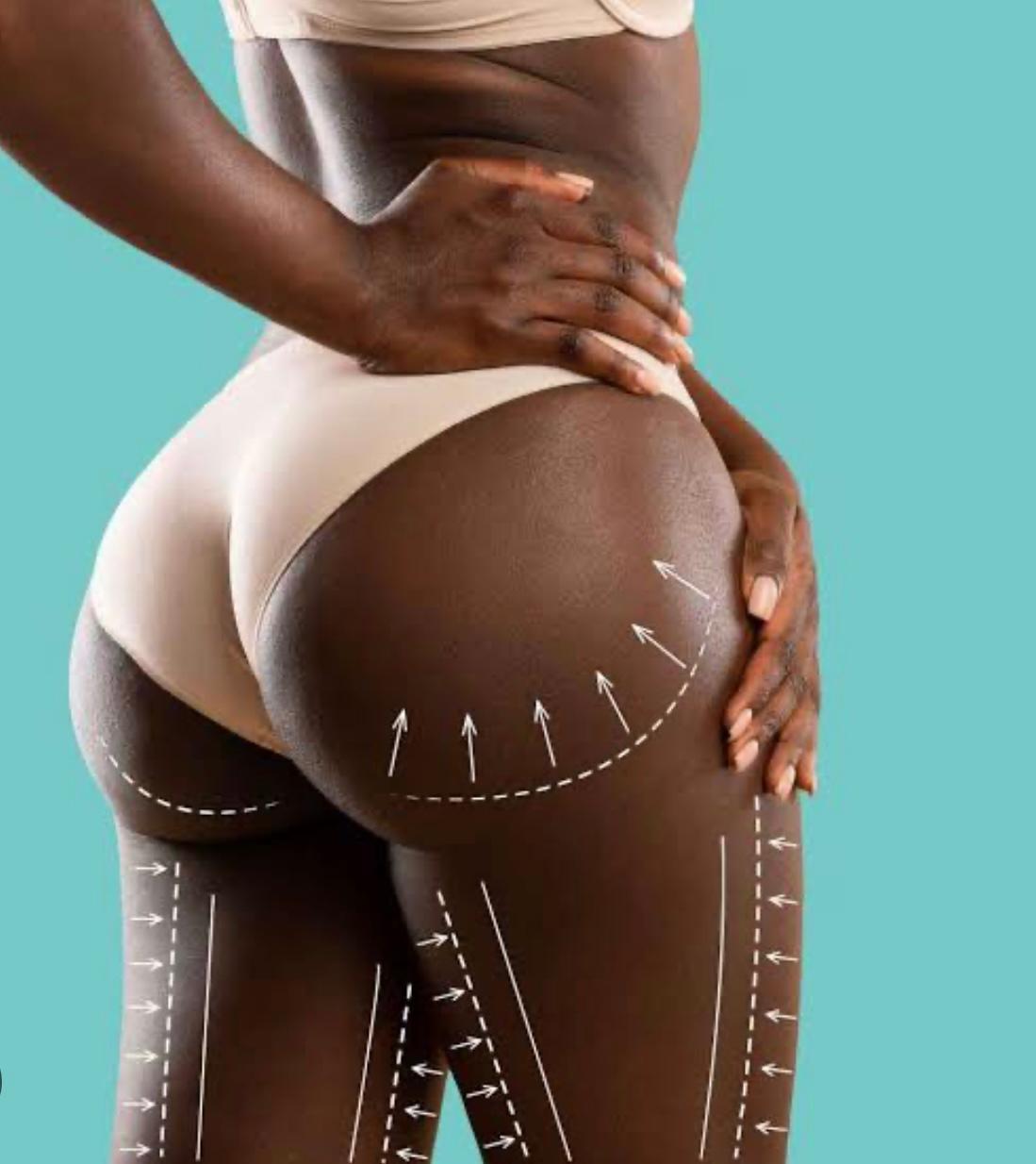 Do Men Prefer BBL Surgeries Over Natural Curves? 5 Nigerian Men